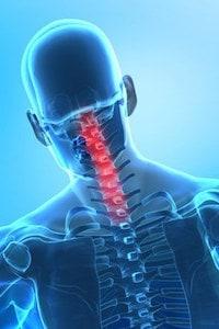 Cervical Spine Injury