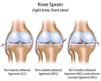 anatomy of a knee injury