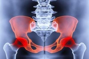 Pelvic Injury